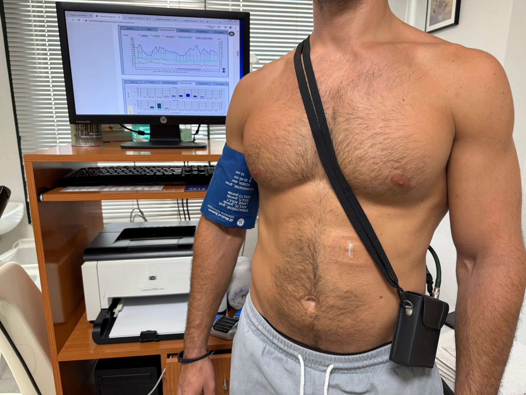 Holter Arterial