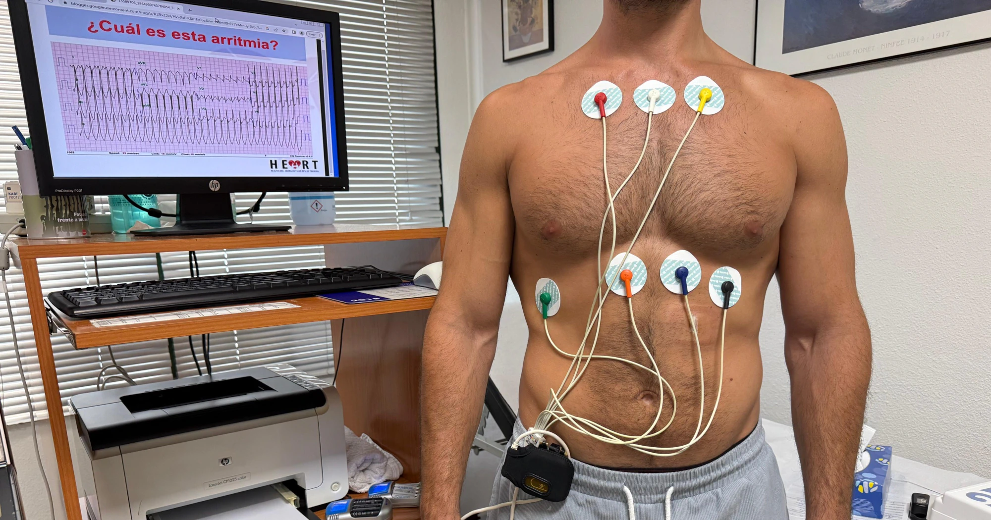 Holter ECG o de Arritmias
